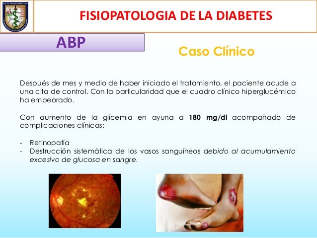 Fisiopatologia de la diabetes mellitus tipo 2 Fisiopatologia de la diabetes mellitus tipo 2