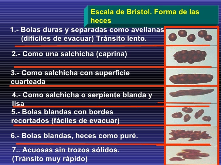 escala de heces de bristol pdf escala de heces de bristol pdf