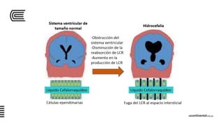 FISIOPATOLOGIA DE LA HIPERTENSION ENDOCRANEANA | PDF