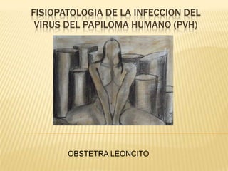FISIOPATOLOGIA DE LA INFECCION DEL
VIRUS DEL PAPILOMA HUMANO (PVH)
OBSTETRA LEONCITO
 
