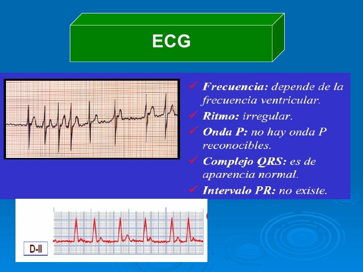 Fisiopatologia De Las Arritmias Fisiopatologia De Las Arritmias