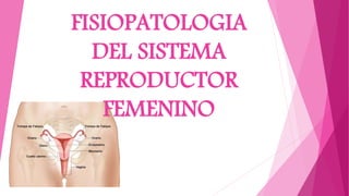 FISIOPATOLOGIA
DEL SISTEMA
REPRODUCTOR
FEMENINO
 