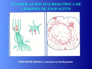 Fisiopatologia digestivo | PPT