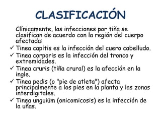 CLASIFICACIÓN 
Clínicamente, las infecciones por tiña se 
clasifican de acuerdo con la región del cuerpo 
afectada: 
 Tinea capitis es la infección del cuero cabelludo. 
 Tinea corporis es la infección del tronco y 
extremidades. 
 Tinea cruris (tiña crural) es la afección en la 
ingle. 
 Tinea pedis (o "pie de atleta") afecta 
principalmente a los pies en la planta y las zonas 
interdigitales. 
 Tinea unguiüm (onicomicosis) es la infección de 
la uñas. 
 