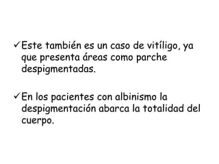 Este también es un caso de vitíligo, ya 
que presenta áreas como parche 
despigmentadas. 
En los pacientes con albinismo la 
despigmentación abarca la totalidad del 
cuerpo. 
 