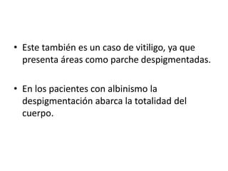 • Este también es un caso de vitiligo, ya que 
presenta áreas como parche despigmentadas. 
• En los pacientes con albinismo la 
despigmentación abarca la totalidad del 
cuerpo. 
 