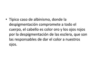 • Típico caso de albinismo, donde la 
despigmentación compromete a todo el 
cuerpo, el cabello es color oro y los ojos rojos 
por la despigmentación de las esclera, que son 
las responsables de dar el color a nuestros 
ojos. 
 