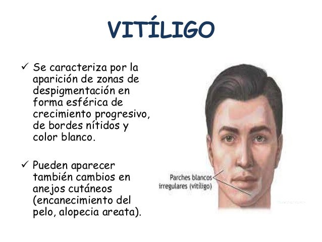 El cuerpo se ha cubierto konopushkami