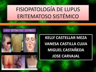 FISIOPATOLOGÍA DE LUPUS
ERITEMATOSO SISTÉMICO


          KELLY CASTELLAR MEZA
          VANESA CASTILLA CUJIA
           MIGUEL CASTAÑEDA
              JOSE CARVAJAL
 