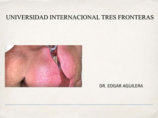 UNIVERSIDAD INTERNACIONAL TRES FRONTERAS
DR. EDGAR AGUILERA
 