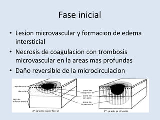 Fase inicial
• Lesion microvascular y formacion de edema
  intersticial
• Necrosis de coagulacion con trombosis
  microvascular en la areas mas profundas
• Daño reversible de la microcirculacion
 