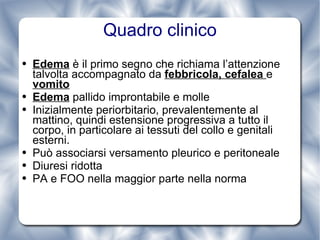 Quadro clinico Edema  è il primo segno che richiama l’attenzione talvolta accompagnato da  febbricola, cefalea  e  vomito Edema  pallido improntabile e molle Inizialmente periorbitario, prevalentemente al mattino, quindi estensione progressiva a tutto il corpo, in particolare ai tessuti del collo e genitali esterni. Può associarsi versamento pleurico e peritoneale Diuresi ridotta PA e FOO nella maggior parte nella norma 