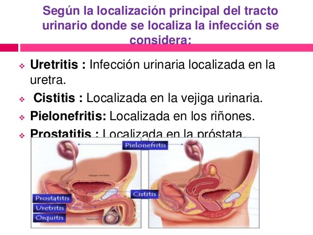 Duele la parte inferior de los riñones da a la derecha en el pie