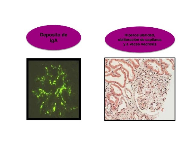 Fisiopatologia sistema urinario 2 Fisiopatologia sistema urinario 2