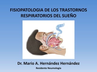 FISIOPATOLOGIA DE LOS TRASTORNOS
RESPIRATORIOS DEL SUEÑO
Dr. Mario A. Hernández Hernández
Residente Neumología
 