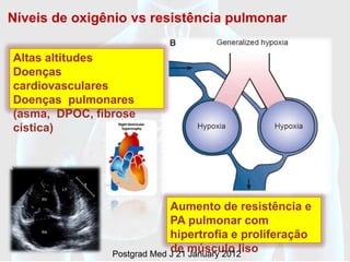 Níveis de oxigênio vs resistência pulmonar

Altas altitudes
Doenças
cardiovasculares
Doenças pulmonares
(asma, DPOC, fibrose
cística)




                             Aumento de resistência e
                             PA pulmonar com
                             hipertrofia e proliferação
                             de músculo liso
                Postgrad Med J 21 January 2012
 