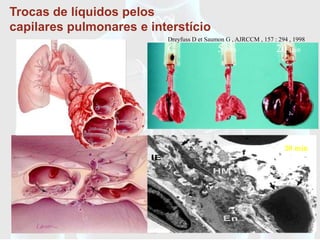 Trocas de líquidos pelos
capilares pulmonares e interstício
                          Dreyfuss D et Saumon G , AJRCCM , 157 : 294 , 1998
                          C                 5 min                20 min




                                                                    20 min
 