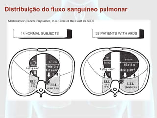 Distribuição do fluxo sanguíneo pulmonar




                RELAÇÃO DE
           VENTILAÇÃO-PERFUSÃO
 