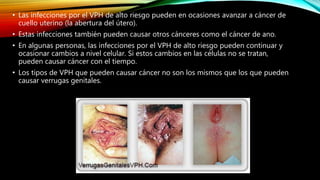 • Las infecciones por el VPH de alto riesgo pueden en ocasiones avanzar a cáncer de
cuello uterino (la abertura del útero).
• Estas infecciones también pueden causar otros cánceres como el cáncer de ano.
• En algunas personas, las infecciones por el VPH de alto riesgo pueden continuar y
ocasionar cambios a nivel celular. Si estos cambios en las células no se tratan,
pueden causar cáncer con el tiempo.
• Los tipos de VPH que pueden causar cáncer no son los mismos que los que pueden
causar verrugas genitales.
 