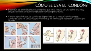 CÓMO SE USA EL CONDÓN?
• El condón es un método anticonceptivo que está hecho de una cobertura muy
delgada de látex de caucho o plástico llamado poliuretano.
• Hay dos tipos básicos de condones disponibles en la mayoría de los países:
condones para ser utilizados por hombres y los hechos para que ser utilizados por
mujeres.
 