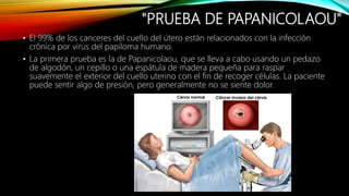"PRUEBA DE PAPANICOLAOU"
• El 99% de los canceres del cuello del útero están relacionados con la infección
crónica por virus del papiloma humano.
• La primera prueba es la de Papanicolaou, que se lleva a cabo usando un pedazo
de algodón, un cepillo o una espátula de madera pequeña para raspar
suavemente el exterior del cuello uterino con el fin de recoger células. La paciente
puede sentir algo de presión, pero generalmente no se siente dolor.
 