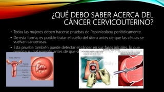 ¿QUÉ DEBO SABER ACERCA DEL
CÁNCER CERVICOUTERINO?
• Todas las mujeres deben hacerse pruebas de Papanicolaou periódicamente.
• De esta forma, es posible tratar el cuello del útero antes de que las células se
vuelvan cancerosas.
• Esta prueba también puede detectar el cáncer en sus fases iniciales, lo que
permite su tratamiento antes de que se agrave.
 