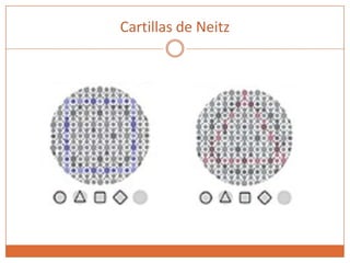 Cartillas de Neitz
 