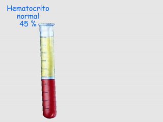 Hematocrito
normal
45 %
 