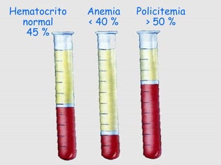 Hematocrito
normal
45 %
Anemia
< 40 %
Policitemia
> 50 %
 
