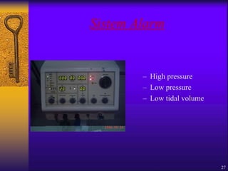 27
Sistem Alarm
– High pressure
– Low pressure
– Low tidal volume
 