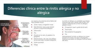 Diferencias clínica entre la rinitis alérgica y no
alérgica
Los signos y los síntomas de la fiebre del
heno pueden incluir:
 Goteo nasal y congestión nasal.
 Ojos llorosos, rojos y que causan
picazón (conjuntivitis alérgica)
 Estornudos.
 Tos.
 Picazón en la nariz, el paladar o la
garganta.
 Piel hinchada y de color azul debajo
de los ojos (ojos morados alérgicos)
 Goteo posnasal.
 Fatiga.
La rinitis no alérgica, es probable que tengas
síntomas que van y vienen todo el año. Los
signos y síntomas de la rinitis no alérgica
pueden incluir:
 Congestión nasal o goteo de la nariz
 Estornudos
 Mucosidad en la garganta
 Tos
Generalmente, la rinitis no alérgica no causa
picazón en la nariz, los ojos o la garganta,
síntomas asociados con alergias como la fiebre
del heno.
 