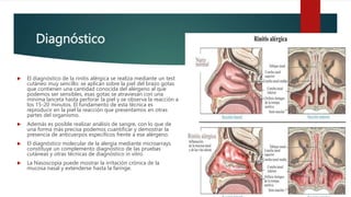 Diagnóstico
 El diagnóstico de la rinitis alérgica se realiza mediante un test
cutáneo muy sencillo: se aplican sobre la piel del brazo gotas
que contienen una cantidad conocida del alérgeno al que
podemos ser sensibles, esas gotas se atraviesan con una
mínima lanceta hasta perforar la piel y se observa la reacción a
los 15-20 minutos. El fundamento de esta técnica es
reproducir en la piel la reacción que presentamos en otras
partes del organismo.
 Además es posible realizar análisis de sangre, con lo que de
una forma más precisa podemos cuantificar y demostrar la
presencia de anticuerpos específicos frente a ese alérgeno.
 El diagnóstico molecular de la alergia mediante microarrays
constituye un complemento diagnóstico de las pruebas
cutáneas y otras técnicas de diagnóstico in vitro.
 La Nasoscopia puede mostrar la irritación crónica de la
mucosa nasal y extenderse hasta la faringe.
 