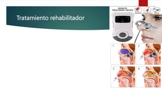Tratamiento rehabilitador
 