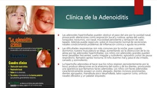 Clínica de la Adenoiditis
 Las adenoides hipertrofiadas pueden obstruir el paso del aire por la cavidad nasal,
provocando alteraciones como respiración bucal y ruidosa, apnea del sueño,
ronquidos nocturnos, voz nasal, mucosidad persistente y sensación de oído
tapado. Además puede repercutir, sobre el movimiento normal de secreciones
nasales condicionando problemas de inflamación crónica o aguda recurrente.
 Las dificultades respiratorias son más comunes por la noche, pues cuando
dormimos nuestra musculatura se relaja, aumentando así la obstrucción de la vía
aérea por las adenoides hipertrofiadas. Los niños con adenoides grandes pueden
tener pesadillas frecuentes, sueño irregular y turbulento, episodios cortos de pausa
respiratorio, llamados apnea nocturna. El niño duerme mal y pasa el día irritado,
cansado y somnoliento.
 La hipertrofia adenoidea al hacer que los niños respiren persistentemente por la
boca, produce alteraciones en la anatomía del rostro y de los dientes, provocando
una apariencia que llamamos facies adenoidea. Los niños con facies adenoidea
característicamente poseen un rostro alargado, dientes incisivos prominentes,
dientes agrupados, mandíbula poco desarrollada, labio superior corto, orificios
nasales elevados y un paladar arqueado.
 