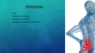 Síntomas
• Dolor
• Inflamación o hinchazón
• Hematomas o Equimosis
• Incapacidad de realizar el movimiento
 