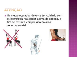 atençãoNa mecanoterapia, deve-se ter cuidado com os exercícios realizados acima da cabeça, a fim de evitar a compressão do arco coracoacromial.