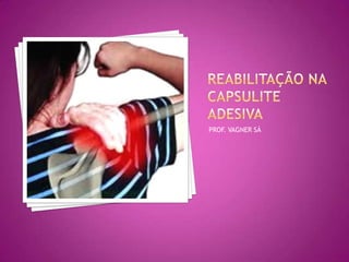 REABILITAÇÃO NA CAPSULITE ADESIVAPROF. VAGNER SÁ