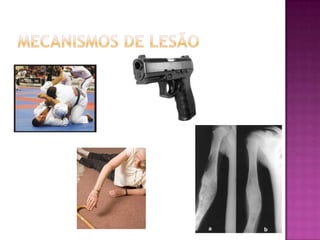 Mecanismos de lesão