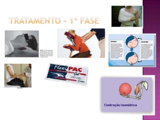 Tratamento – 1ª fase