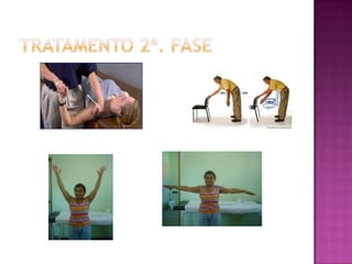 Tratamento 2ª. fase