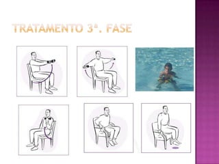 Tratamento 3ª. fase