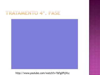 Tratamento 4ª. fasehttp://www.youtube.com/watch?v=TaFg2PljVLc