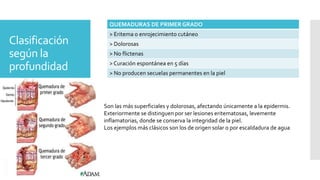 Clasificación
según la
profundidad
QUEMADURAS DE PRIMER GRADO
> Eritema o enrojecimiento cutáneo
> Dolorosas
> No flictenas
> Curación espontánea en 5 días
> No producen secuelas permanentes en la piel
Son las más superficiales y dolorosas, afectando únicamente a la epidermis.
Exteriormente se distinguen por ser lesiones eritematosas, levemente
inflamatorias, donde se conserva la integridad de la piel.
Los ejemplos más clásicos son los de origen solar o por escaldadura de agua
 