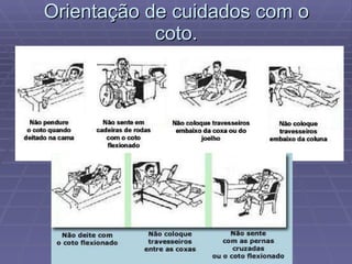 Orientação de cuidados com o coto. 