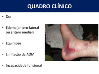 QUADRO CLÍNICO
• Dor
• Edema(antero-lateral
ou antero medial)
• Equimose
• Limitação da ADM
• Incapacidade funcional
 