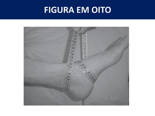 FIGURA EM OITO
 