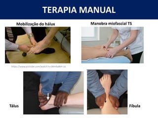 TERAPIA MANUAL
https://www.youtube.com/watch?v=jWmkx8kH-zo
Mobilização do hálux Manobra miofascial TS
Tálus Fíbula
 