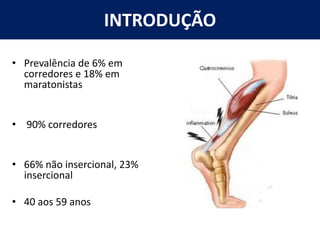 INTRODUÇÃO
• Prevalência de 6% em
corredores e 18% em
maratonistas
• 90% corredores
• 66% não insercional, 23%
insercional
• 40 aos 59 anos
 