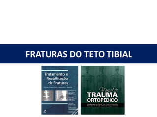 FRATURAS DO TETO TIBIAL
 