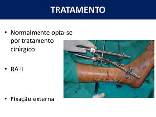 TRATAMENTO
• Normalmente opta-se
por tratamento
cirúrgico
• RAFI
• Fixação externa
 